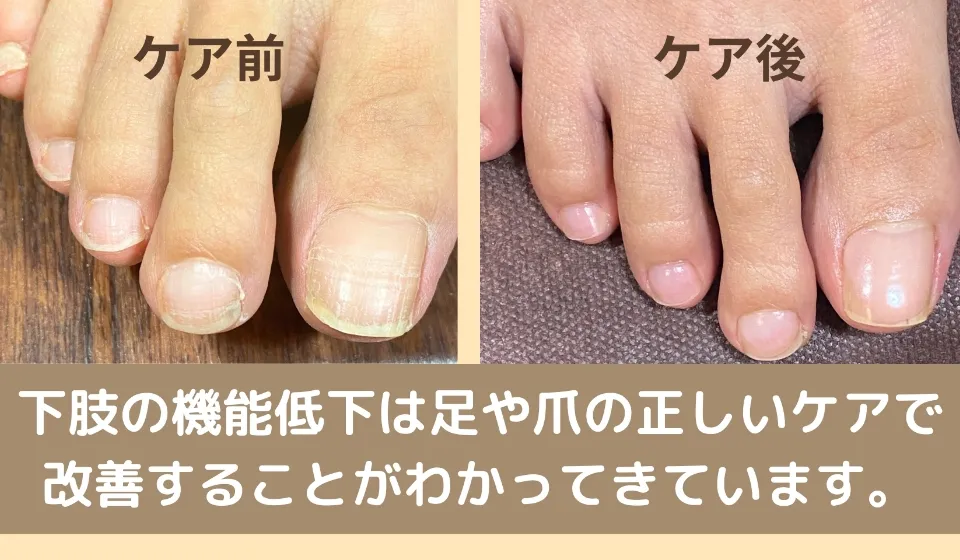 足や足の爪の正しいケア